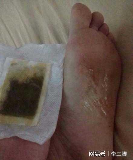这4种产品,并没有宣传的那么 神奇 ,还可能有害,别买 护垫 被子 枕头 皮肤科医生 网易订阅