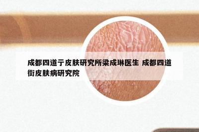 成都四道亍皮肤研究所梁成琳医生 成都四道街皮肤病研究院