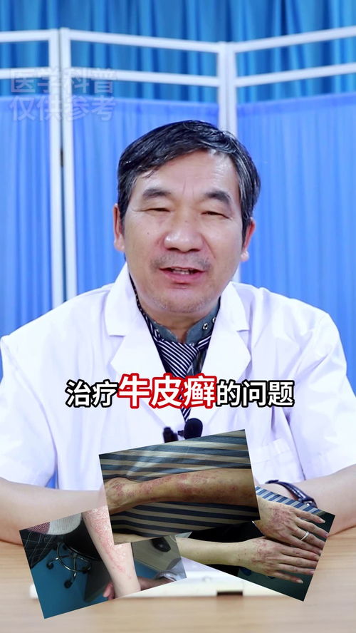 潍坊皮肤病银康研究院王尚和 30秒讲清银屑病这种针怎么打