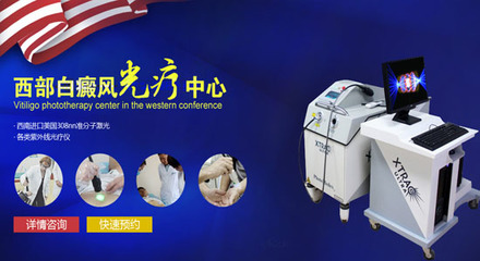 四川哪有专科医院治得好白癜风