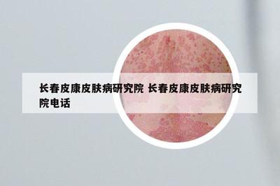 长春皮康皮肤病研究院 长春皮康皮肤病研究院电话
