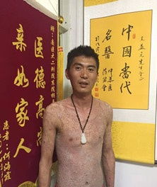 大医精诚承国粹 济世救人焕新颜 记中医治疗皮肤病之大国工匠王益元