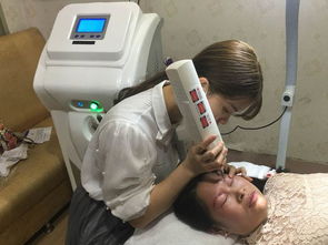 始元淑专业祛斑祛痘加盟优势