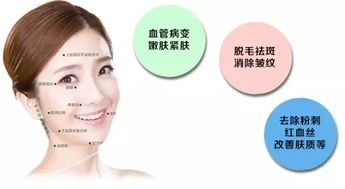 怎样祛斑最有效 美容院祛斑小妙招分享