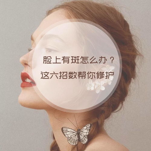 有谁有祛斑成功的经历吗