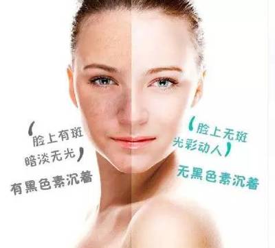 全城寻找50名免费祛斑体验者,别做一“斑”的女人!