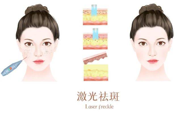 阜阳皮肤病医院:春季科学祛斑,该如何做?
