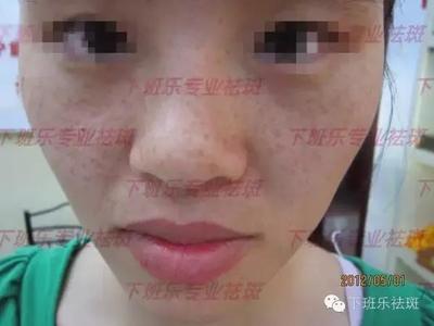 记者采访下班乐创始人杨惠馨是如何祛斑的经过-时尚频道-手机