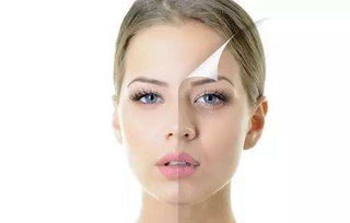 脸颊两侧长斑的原因与专业祛斑方法