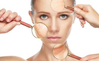 科学淡斑全攻略 从成因到方案，理性选择祛斑产品