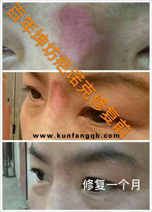 专业祛斑祛痘加盟代理指南 如何选择与加盟优质美容院品牌